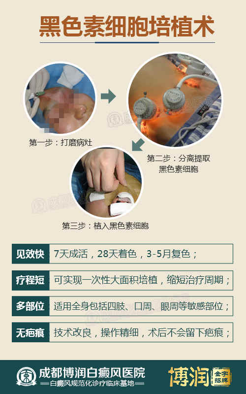 白癜风“黑色素细胞培植治疗基金援助”,11月15—30日正式启动 白癜风“黑色素细胞培植治疗基金援助”,11月15—30日正式启动