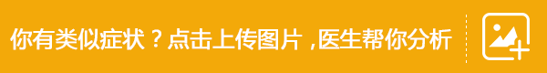 白癜风“黑色素细胞培植治疗基金援助”,11月15—30日正式启动 白癜风“黑色素细胞培植治疗基金援助”,11月15—30日正式启动
